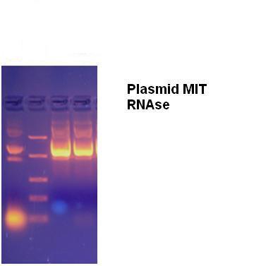 Plasmid DNA mit RNAse.JPG