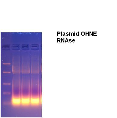 Plasmid DNA ohne RNAse.JPG